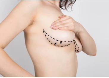 what-are-the-risks-of-a-breastlift-mastopexy-turkey