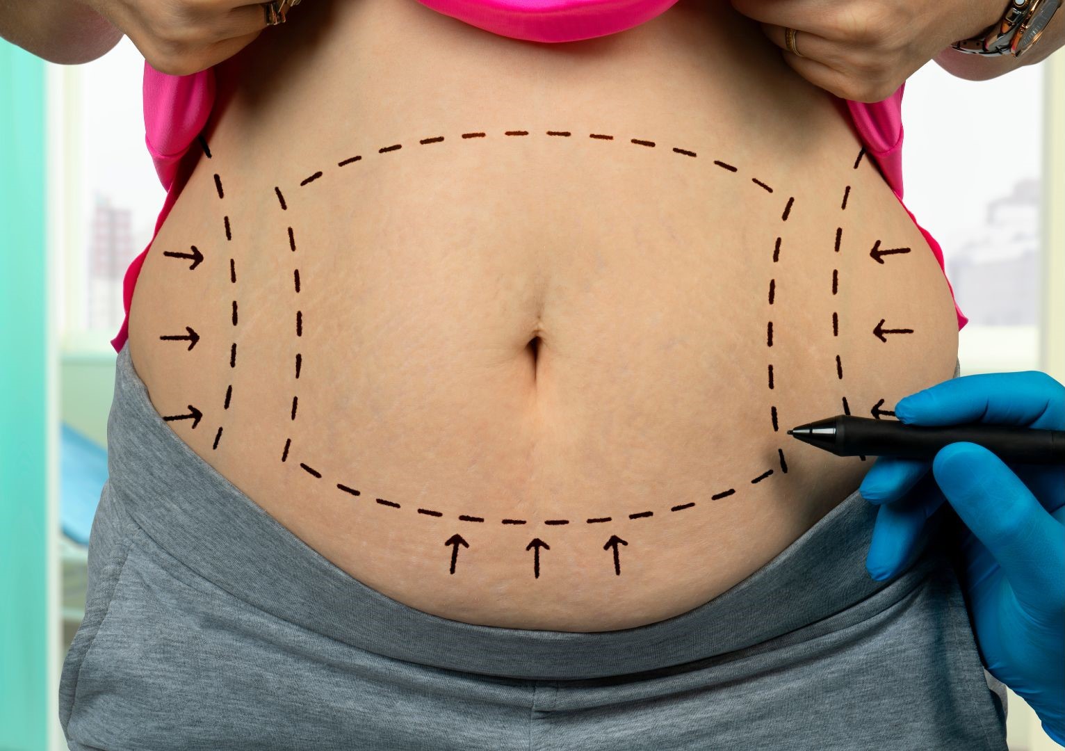 What are the risks & complications of liposuction surgery?in Turkey, Istanbul