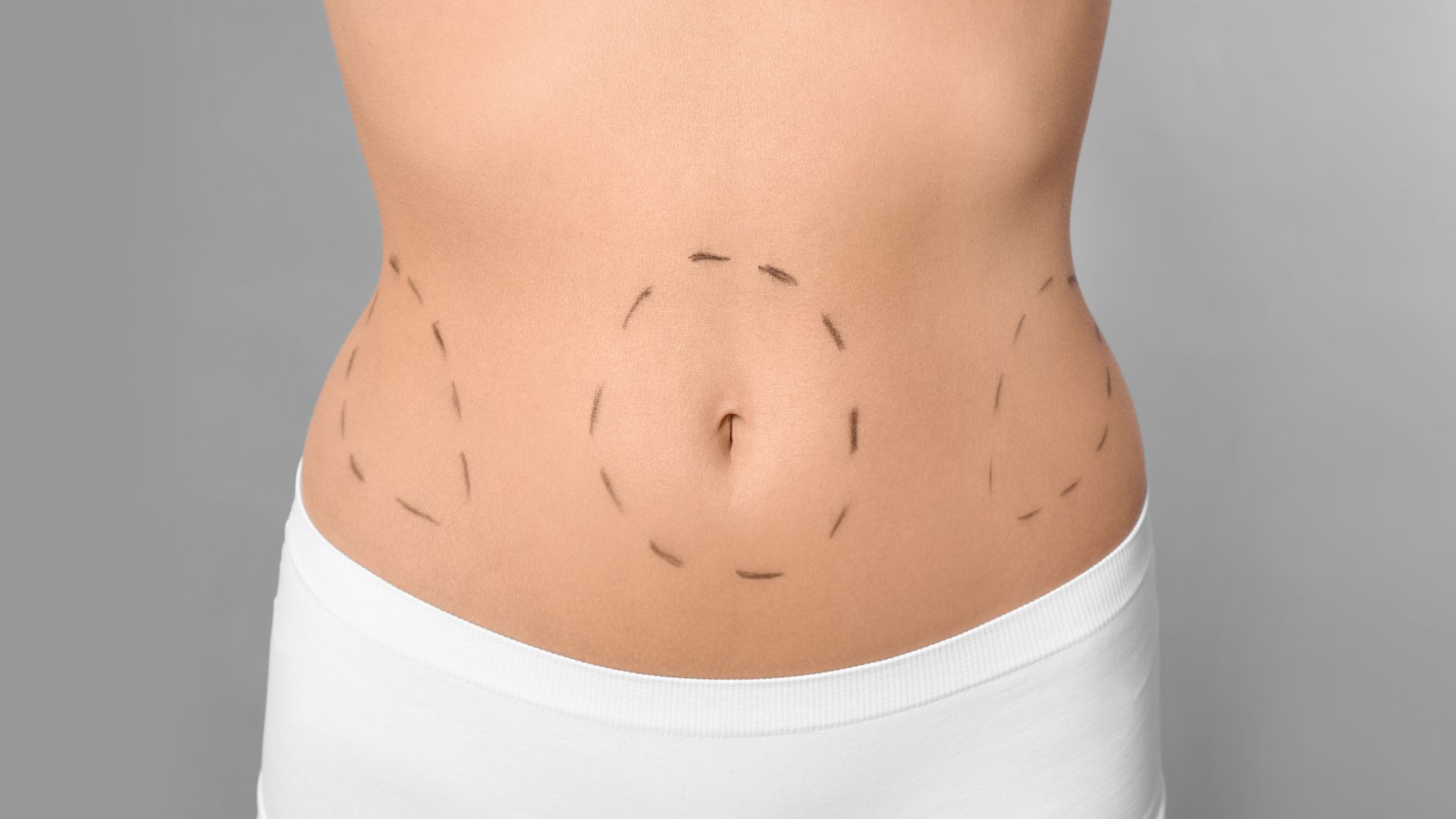 The risks of tummy tuck surgery: Is abdominoplasty safe?-istanbul-turkey